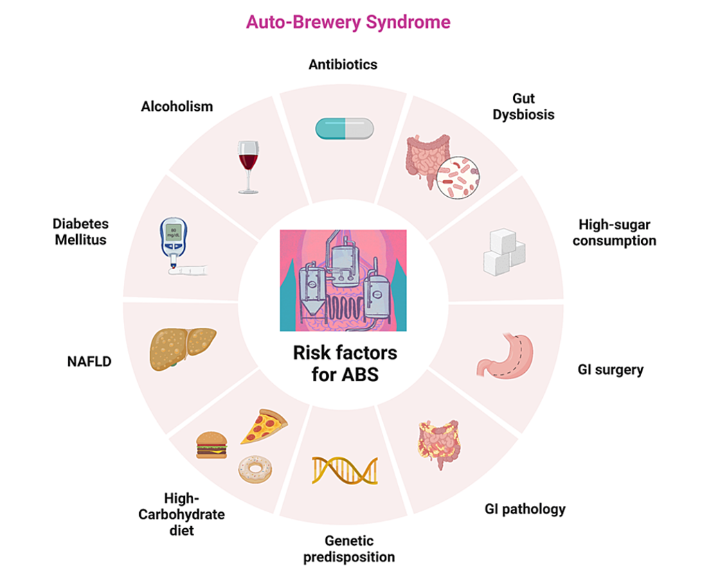 Auto-Brewery Syndrome