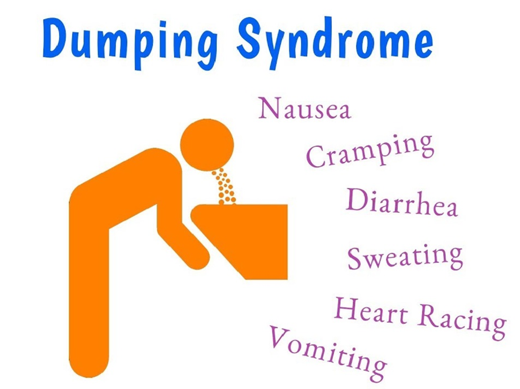 Dumping Syndrome