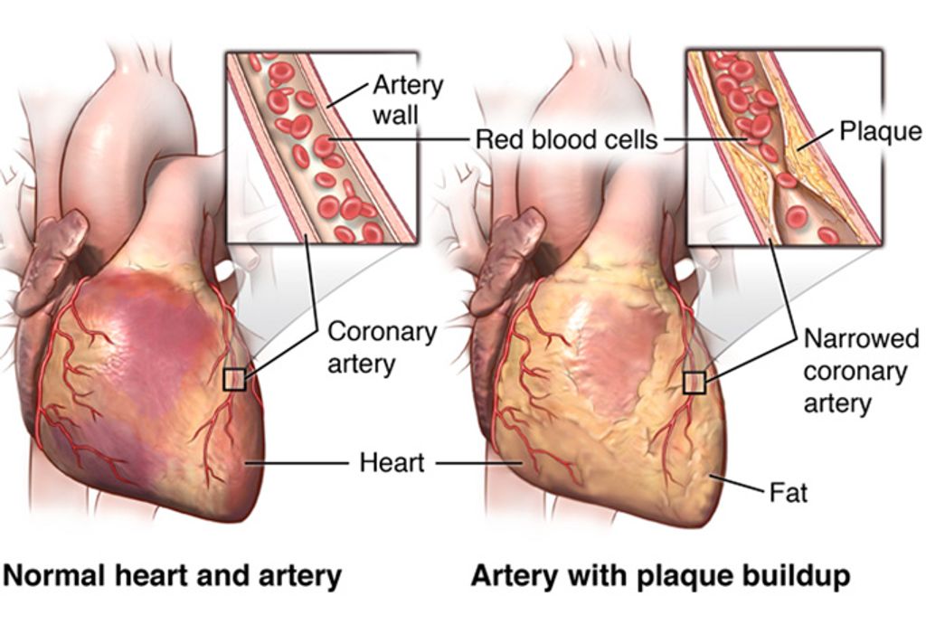 Advancing Cardiac Care