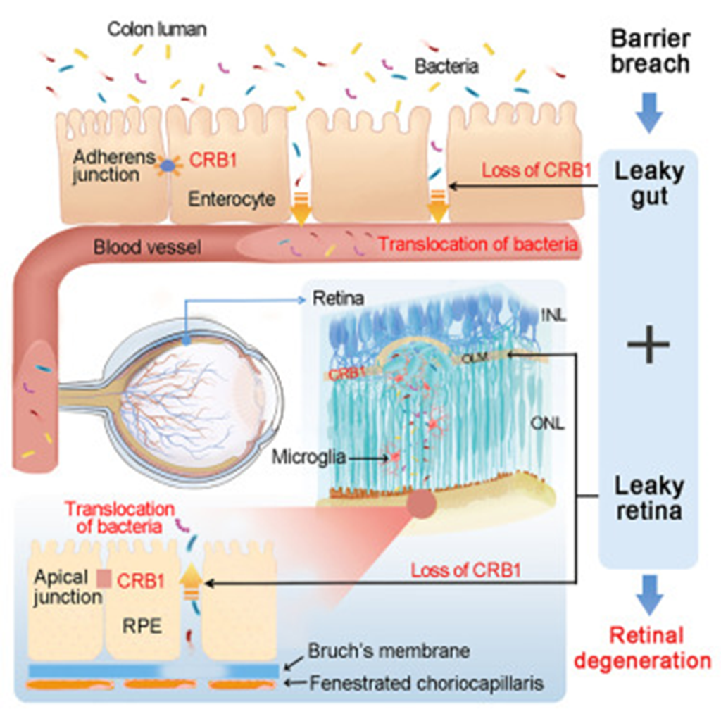 Exploring the Surprising Link Between Gut Bacteria and Eye Health