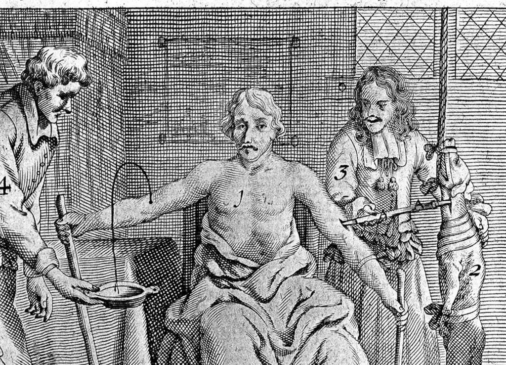 Milk Transfusions: The Bizarre Chapter in Medical History