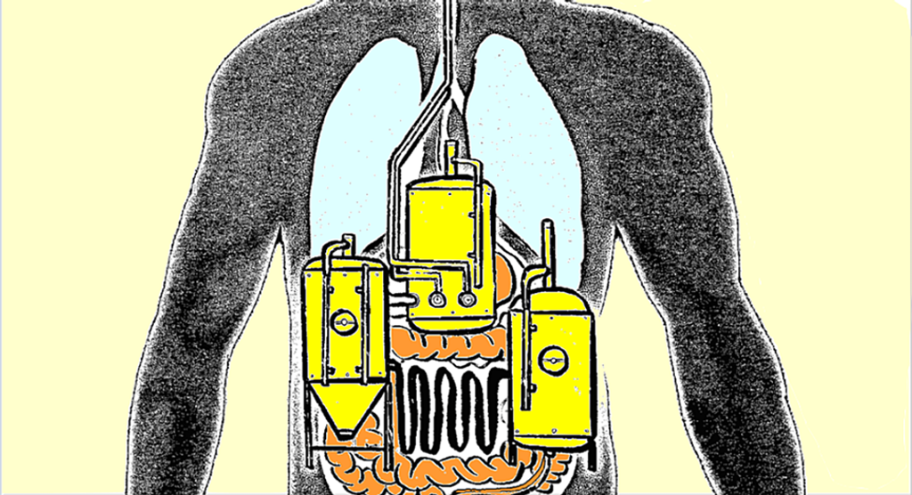 A Case of Auto-Brewery Syndrome: The Unseen Culprit Behind Unexpected Intoxication