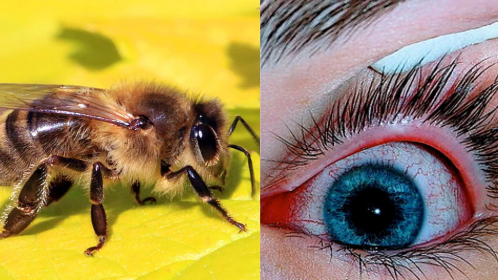 Eye Pain Reveals Four Bees Feeding on Tears