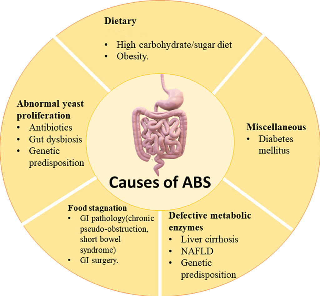 A Case of Auto-Brewery Syndrome: The Unseen Culprit Behind Unexpected Intoxication